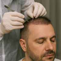 Hair and Beard Restoration Icon