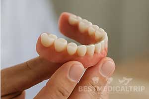 Temporary Denture