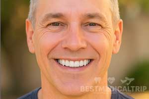 Smile Result