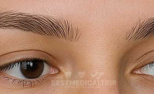 Natural eyebrow result